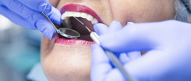 Best Dentist for Tooth Abscess  in Quinnesec, MI